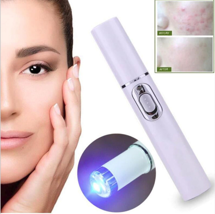 Laser Pen- Acne, Wrinkle, Soft Scar, Dark Circles, Remover.